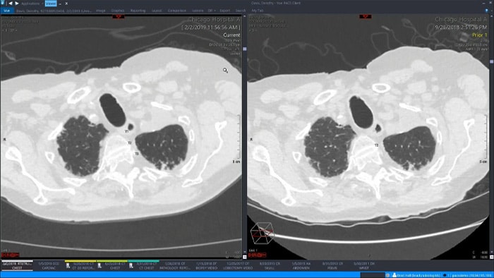 Demonstration of Philips single radiology workspace with advanced visualization