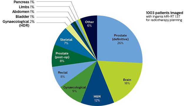 Turku MRI radiation therapy treatment planning