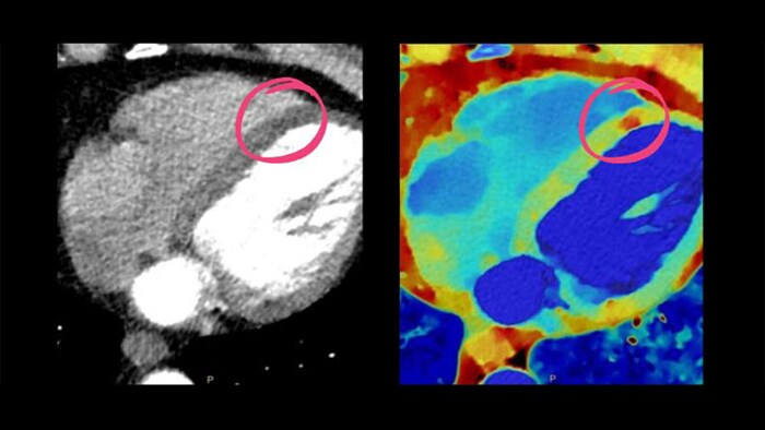 Cardiac diagnostic tool